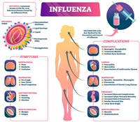 influenza.jpg