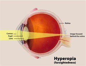 farsighted1.jpg