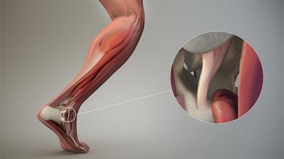 Ligament (1).jpg