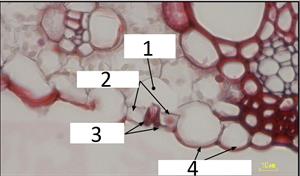 stomatalapparatus que.jpg