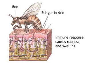 beebu=ite.jpg