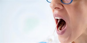 Genetic-Methylation-Test-Buccal-Mouth-Swab.jpg